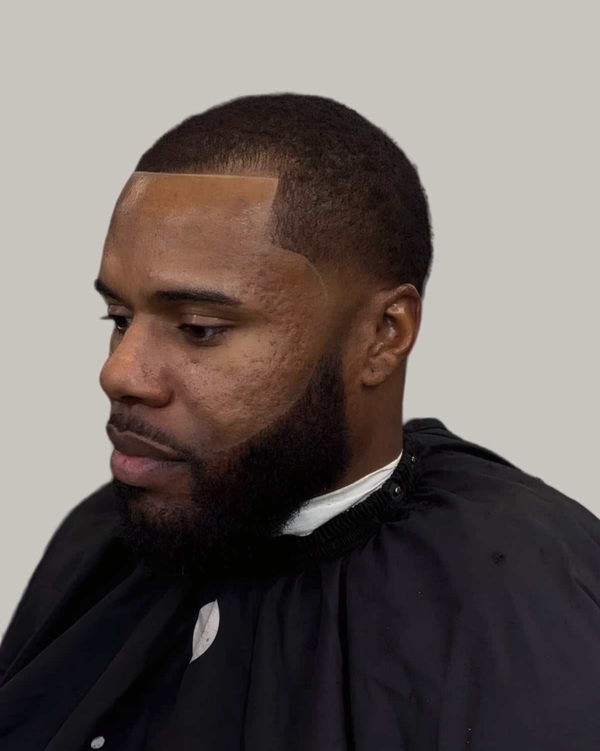 Man with a full beard and a low cut, seen at an angle