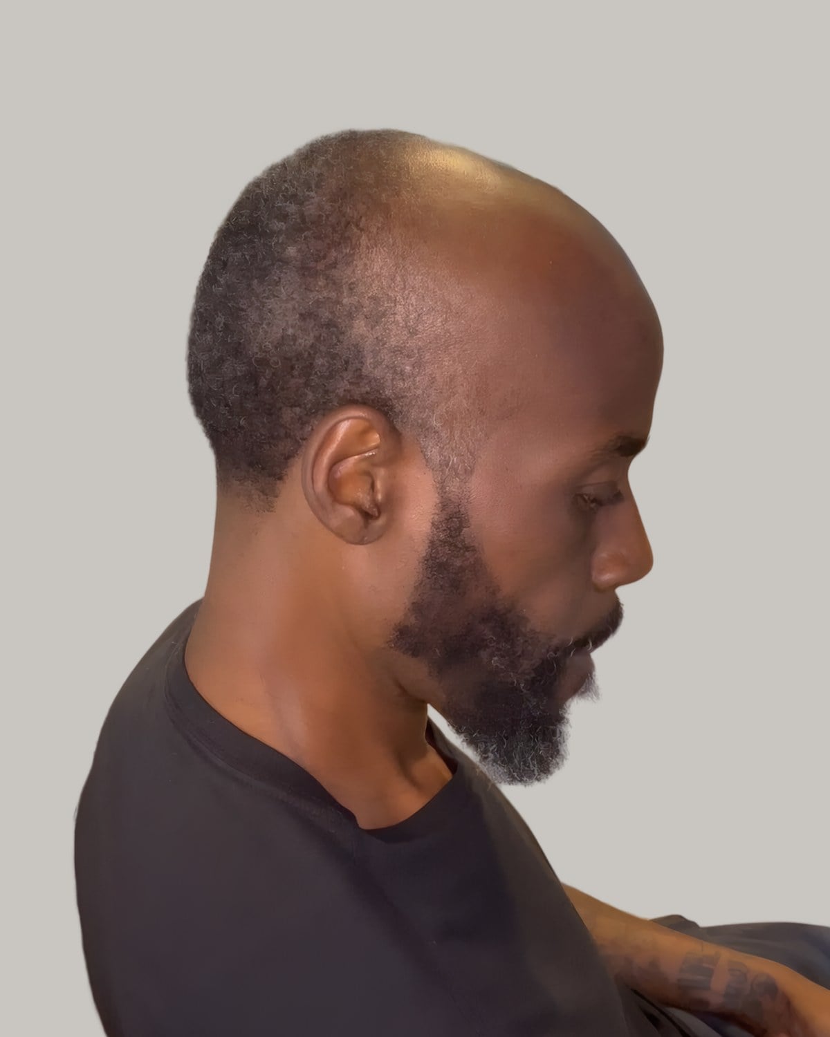 Bearded man with a bald fade and a very short thinning top, seen in profile